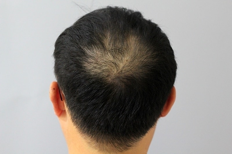 수술전2.jpg
