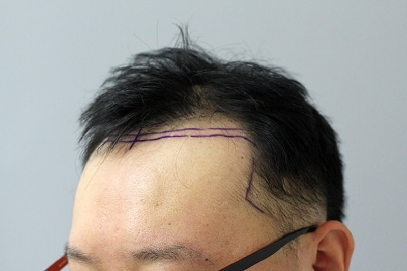 수술전3.jpg