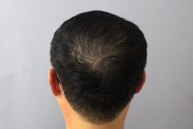수술후2.jpg