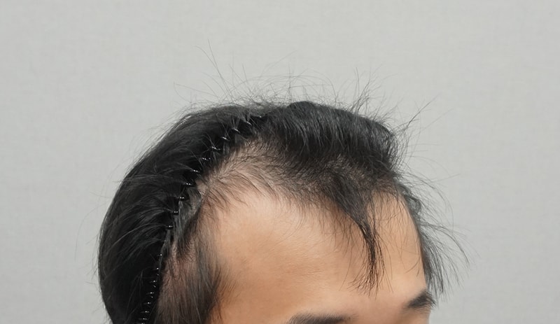 It is a review after 1 year and 4 months of Mo Plus non-cut 2600 Mo.