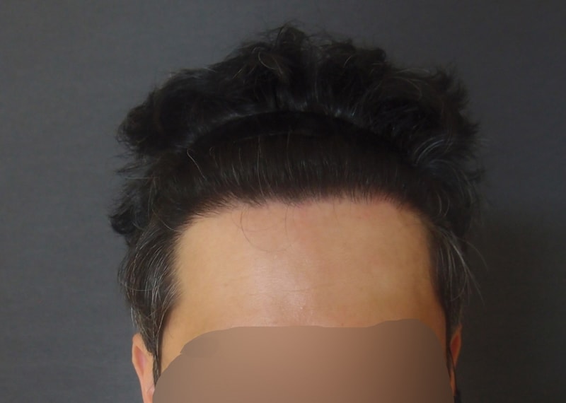 수술후1.jpg