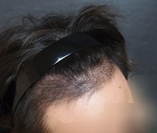 수술후2.jpg