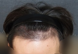 수술후1.jpg
