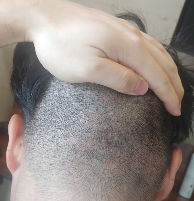 9일차 뒤통수.jpg