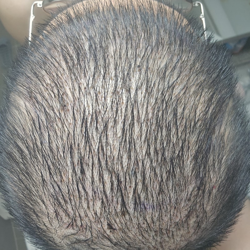 포토후기 이미지
