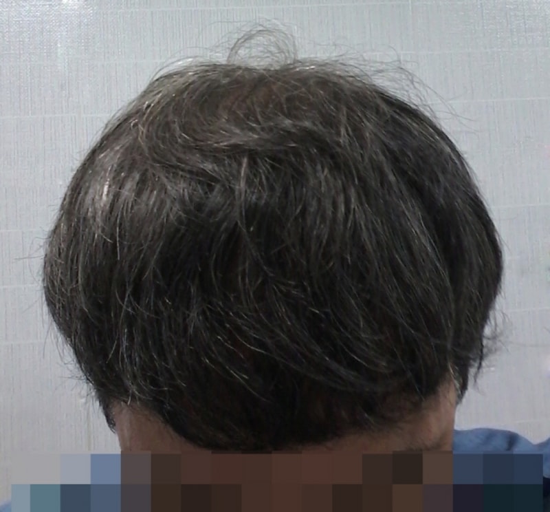 1年以上混合/ みんな頑張ってイメージ変身してください~ ファイト！！！