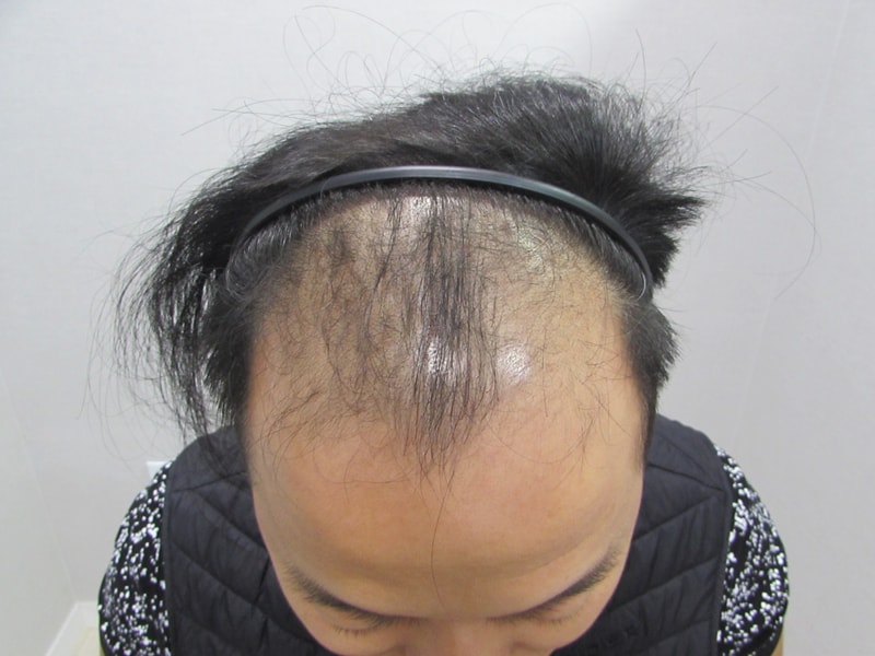 수술전2.jpg