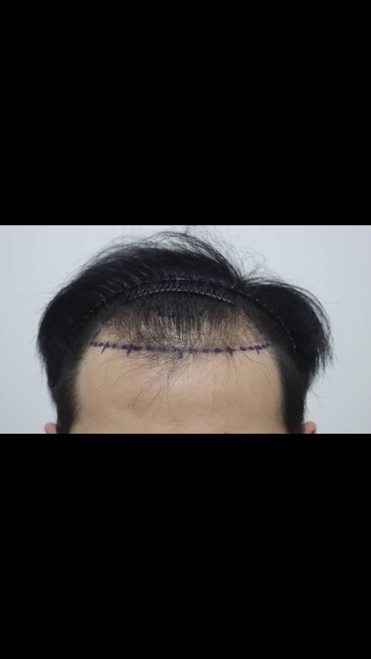0519B893-9E8E-4C1A-8AB4-39C8ABFA0B6B.png