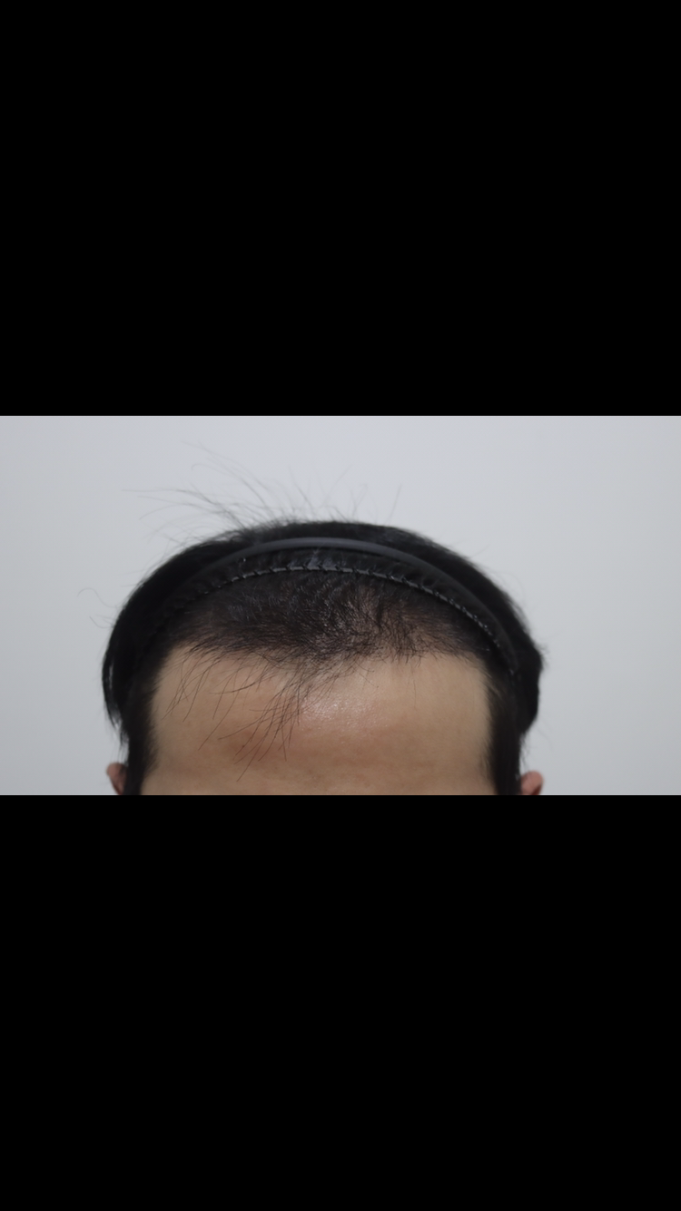 798F1DA0-C8AD-41CA-984A-ABCCB4E70A83.png