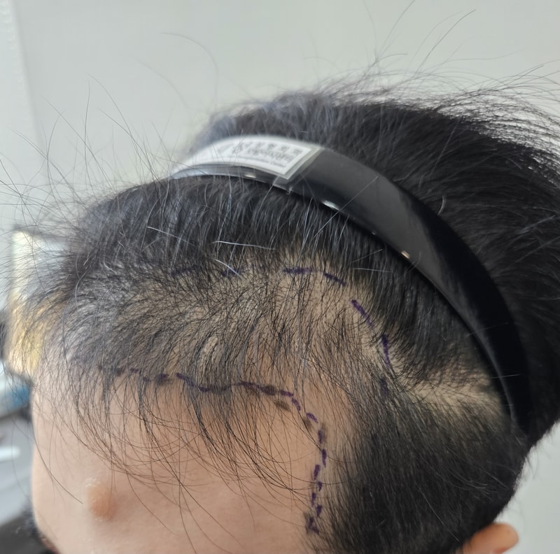 포토후기 이미지