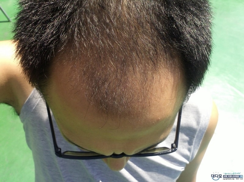 크기변환_0f3158d131cd334bd72c224ba2290415.jpg