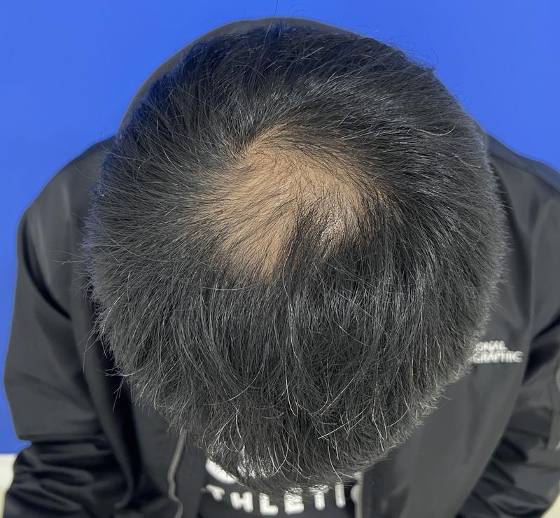 수술전 1.jpg