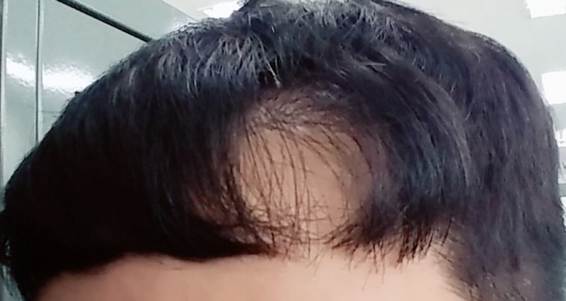 1503294414764s.jpg