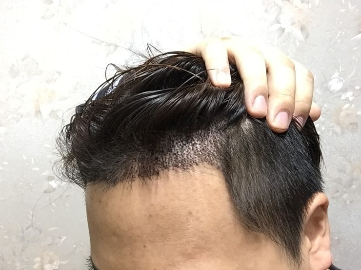 셀카샷_좌측.jpg