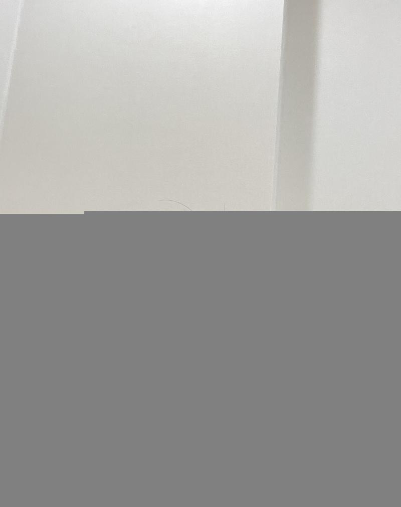 女性ヘアライン毛髪移植3ヶ月目のレビュー