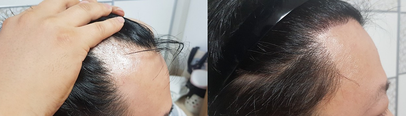 비포오오엡터터터.PNG