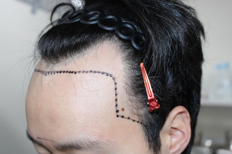 포토후기 이미지