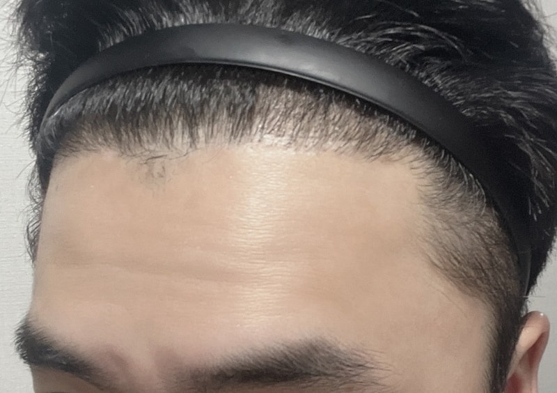 꾸미기김민준_오른쪽_후.jpg