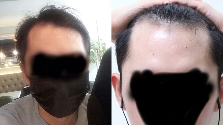 비포.jpg