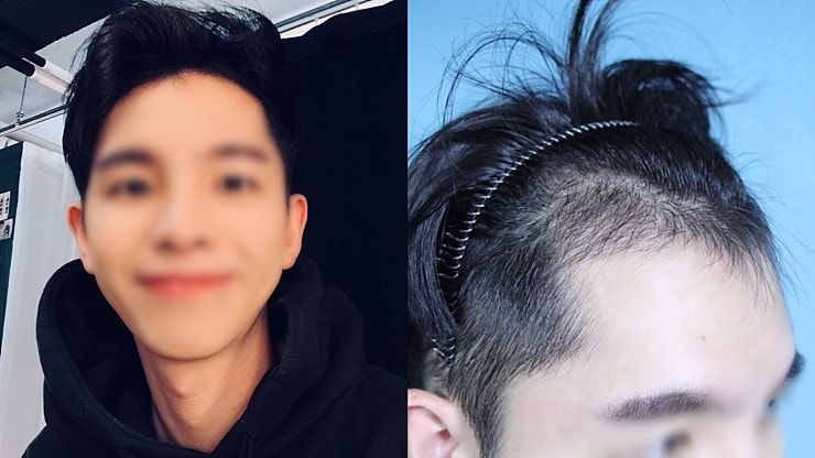 3개월.jpg