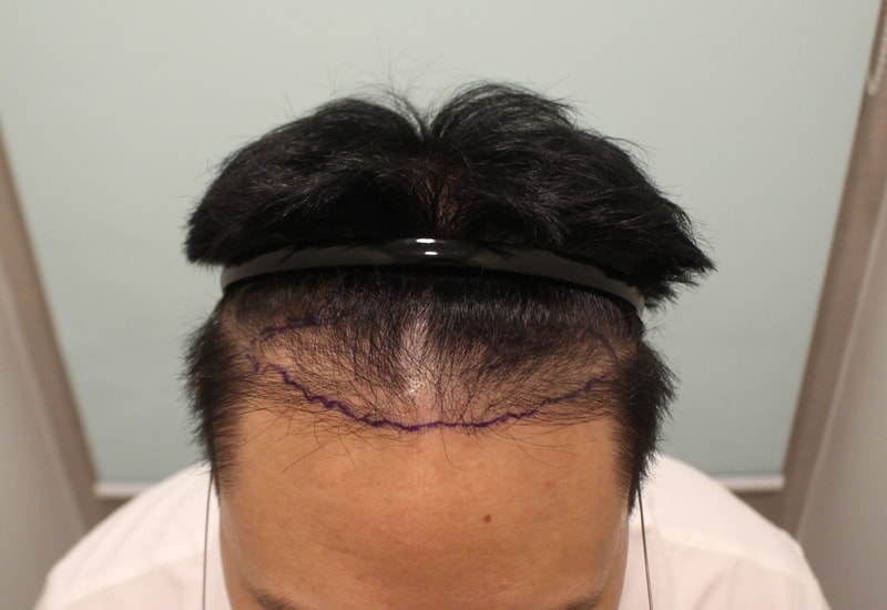 이제는 나 머리 넘깁니다