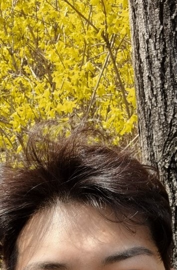 40个月了，啊啊啊啊，在Dana做过。