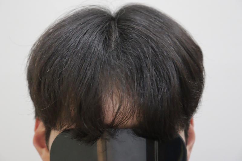光州狎鸥亭Mobian医院经过2周后记