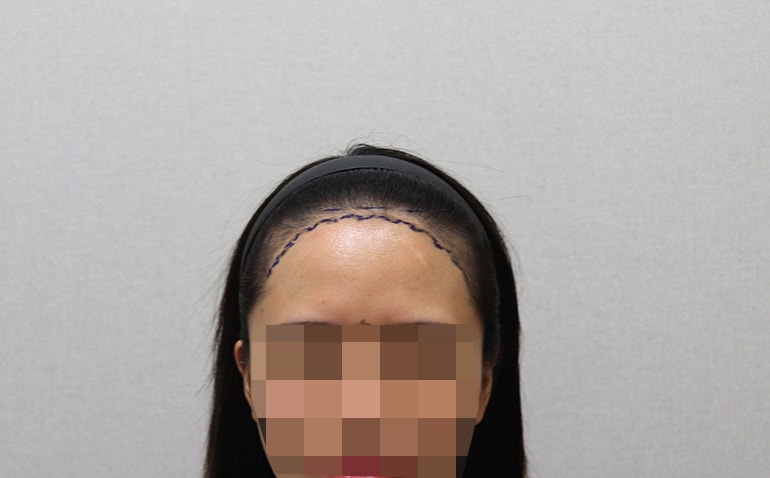 포토후기 이미지