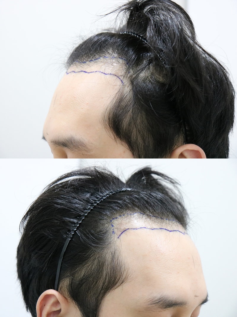 2 옆에서 보면 더 깊어보이는 엠자 ㅜㅜ.jpg