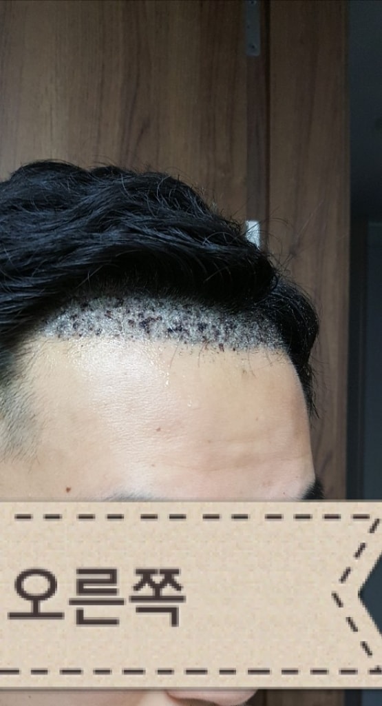 KakaoTalk_20170719_142709372.jpg