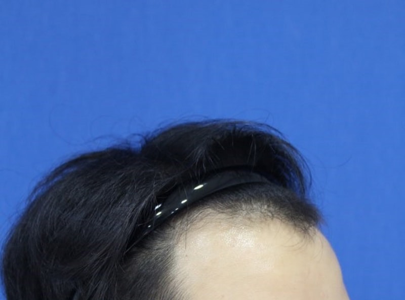 수술전2.jpg