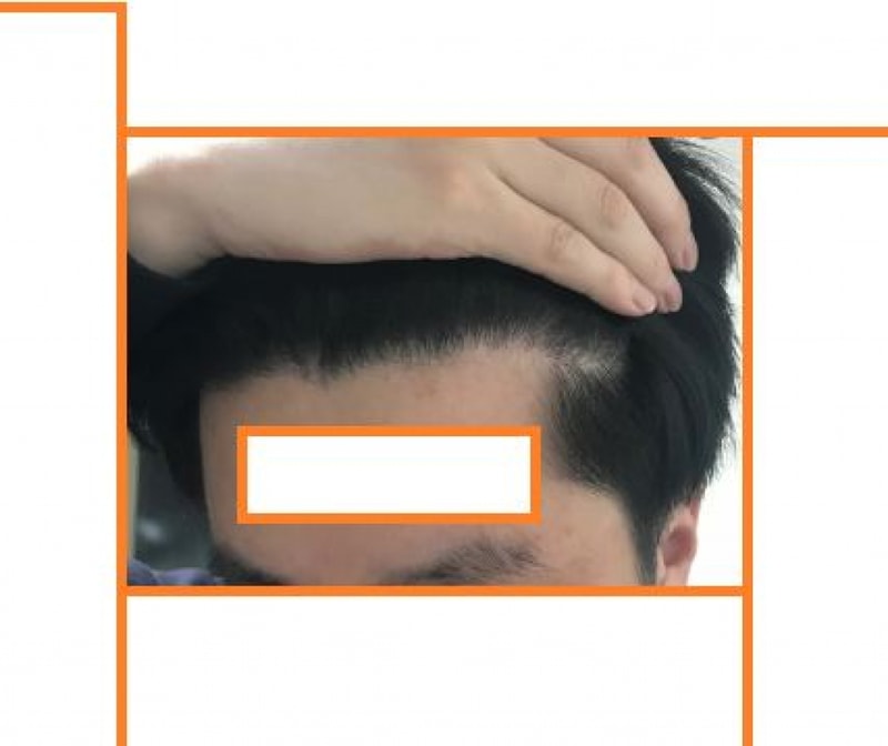 좌측1.JPG