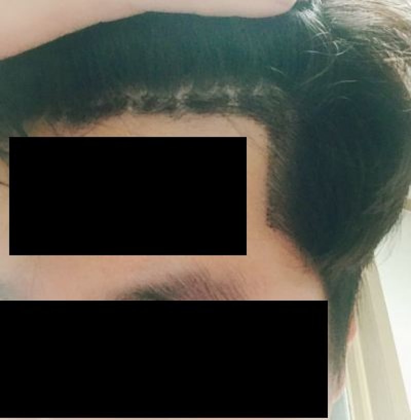 8일차우측.JPG