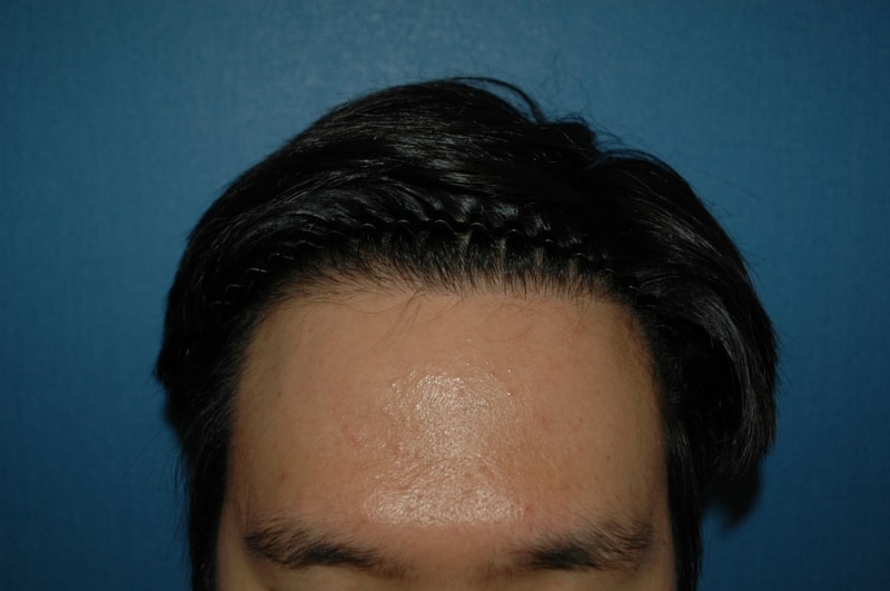 after.JPG