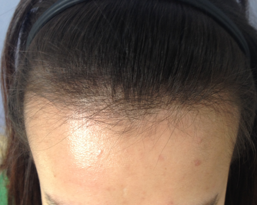 포토후기 이미지