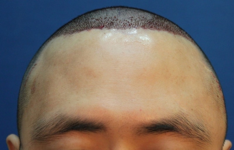 01.jpg