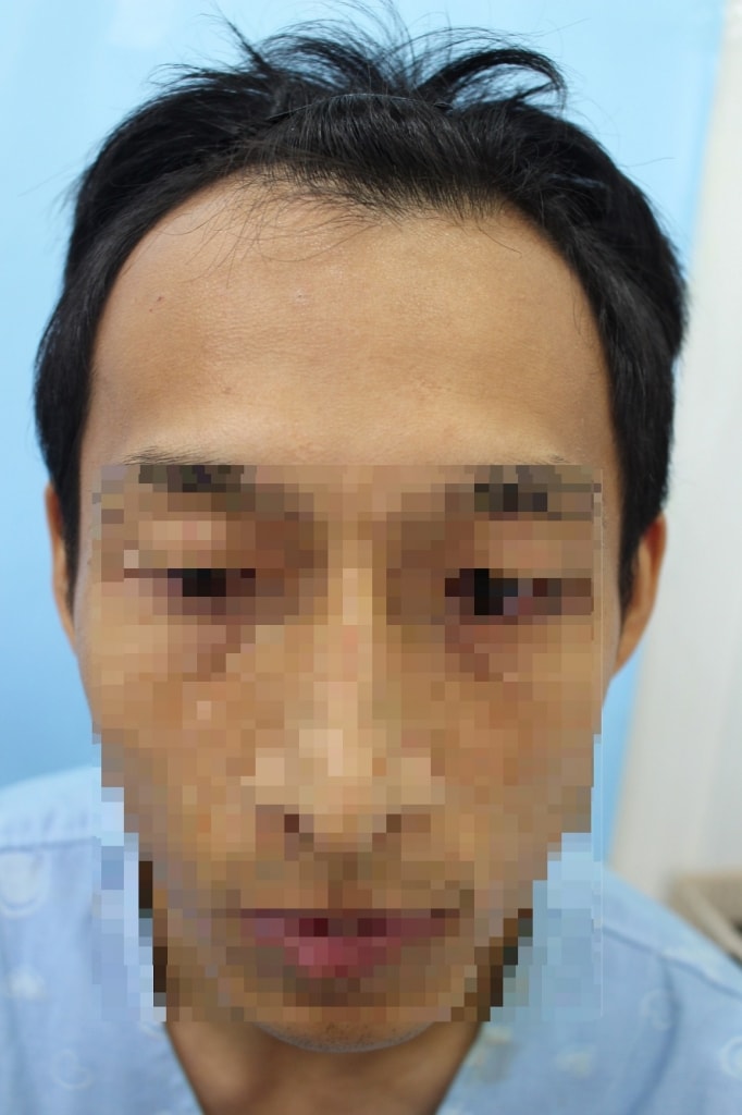 정면_2.JPG
