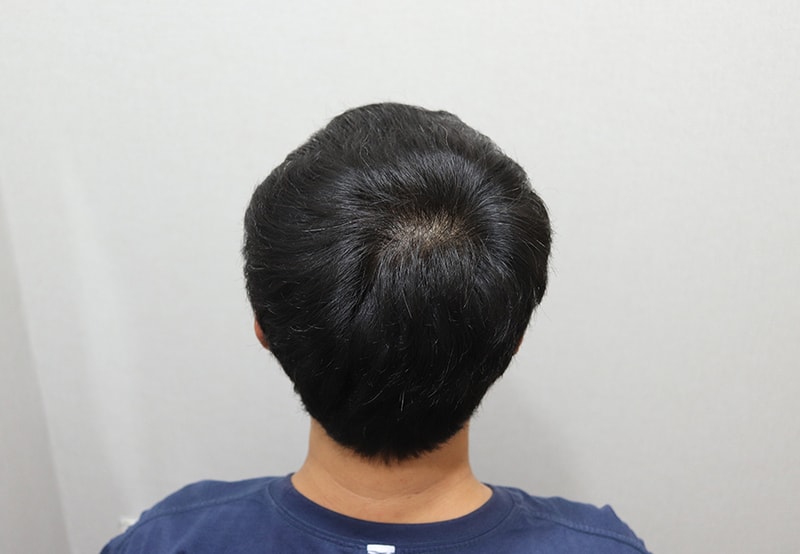 6. 1년 경과 IMG_4757.JPG