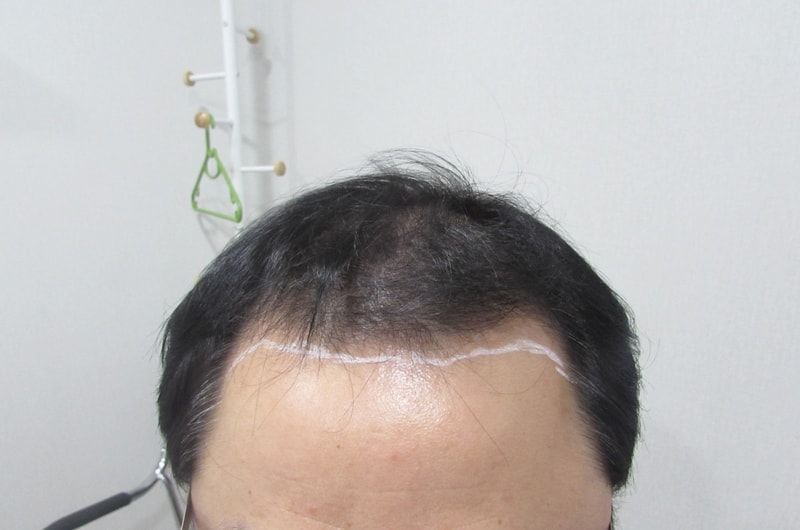 수술전1.jpg