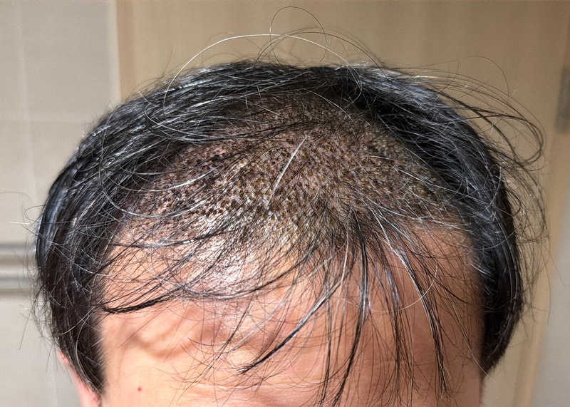 After.jpg