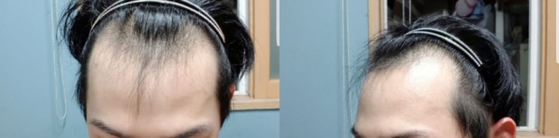 전.jpg