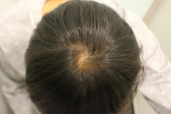 薄っぺらな上釜の数を補強、もみあげ密度