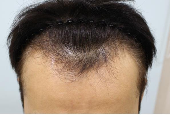 It's a non-cut 3500-mo 29-month-old, second line down