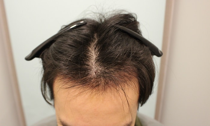 수술후 12일 3.JPG