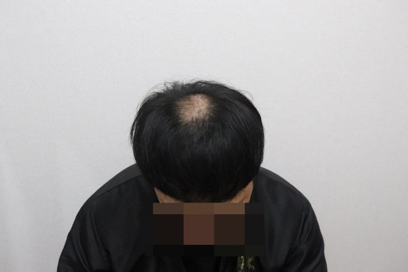 3개월.jpg