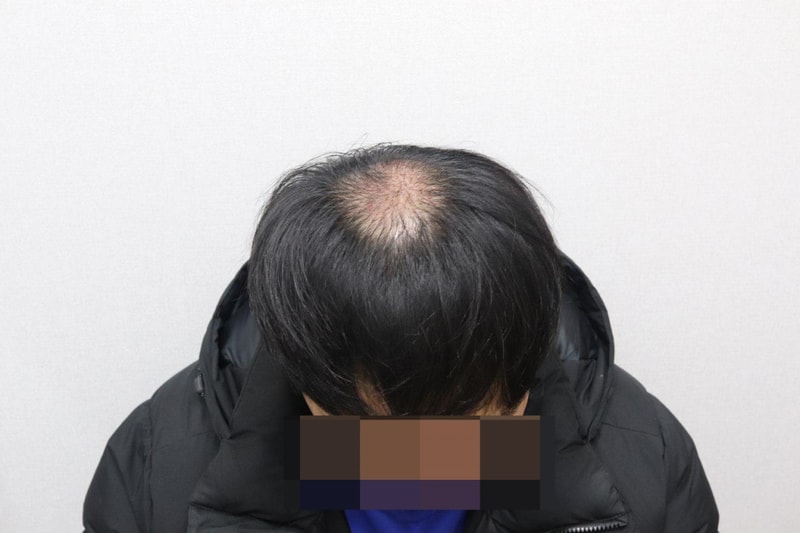 1개월.jpg
