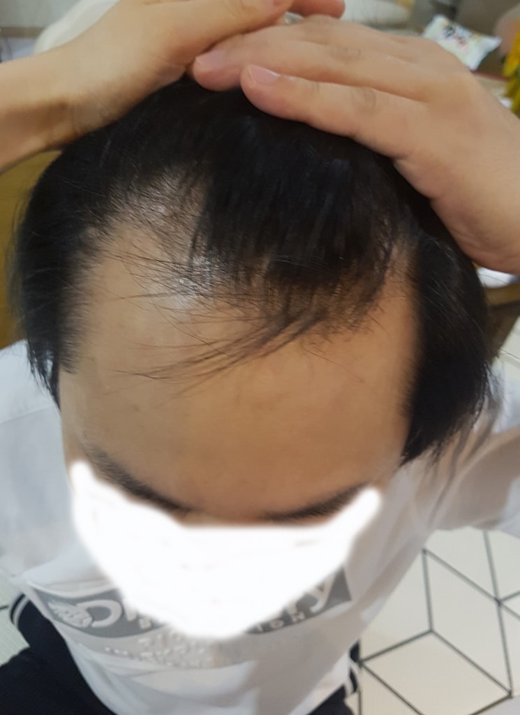 手術を受けて来ました