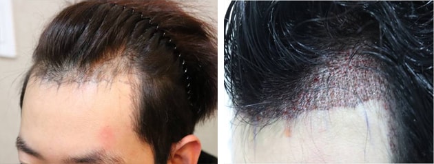 수술당일1.jpg