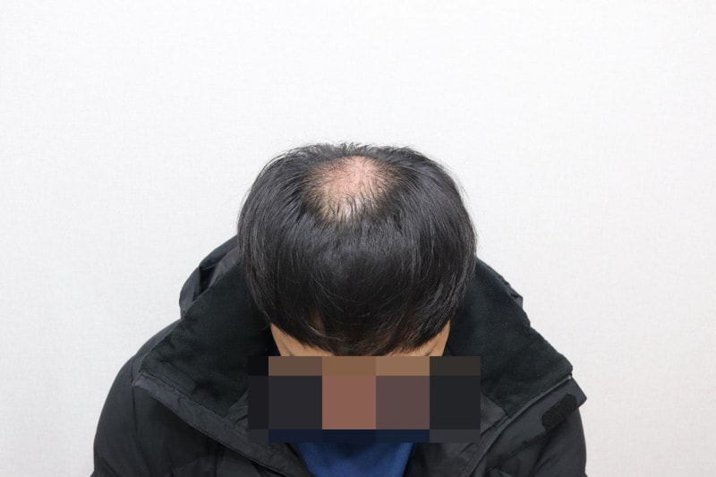 2개월.jpg
