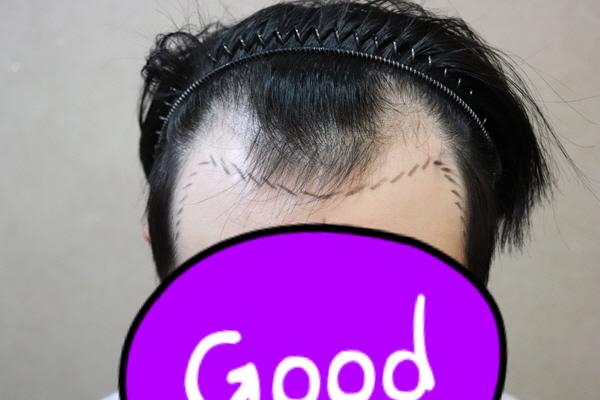 101.jpg